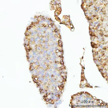 GHRH Rabbit Polyclonal Antibody