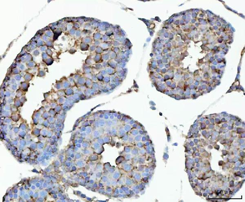 GHRH Rabbit Polyclonal Antibody