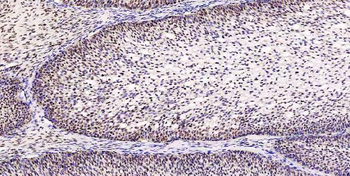 Musashi 1/Msi1 Rabbit Polyclonal Antibody