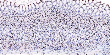 Musashi 1/Msi1 Rabbit Polyclonal Antibody
