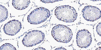 Musashi 1/Msi1 Rabbit Polyclonal Antibody