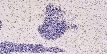 Musashi 1/Msi1 Rabbit Polyclonal Antibody