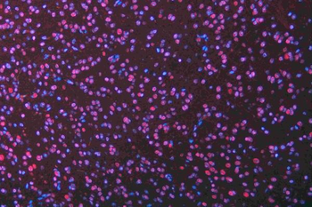 Musashi 1/Msi1 Rabbit Polyclonal Antibody