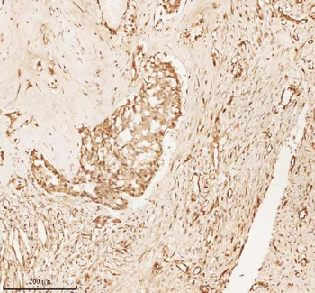 NUP43 Rabbit Polyclonal Antibody