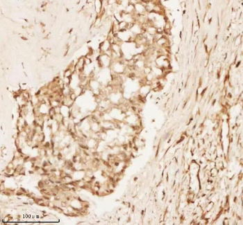 NUP43 Rabbit Polyclonal Antibody