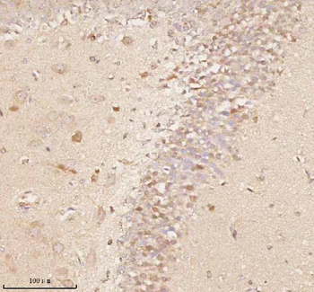 NUP43 Rabbit Polyclonal Antibody