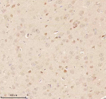 NUP43 Rabbit Polyclonal Antibody