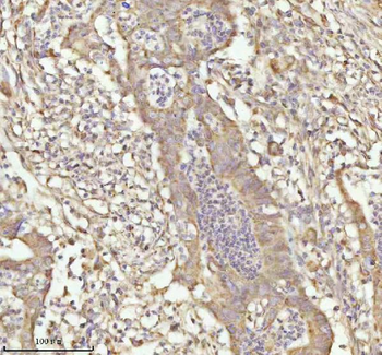NDUFA9 Rabbit Polyclonal Antibody