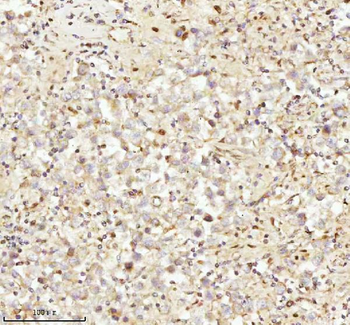 NDUFA9 Rabbit Polyclonal Antibody