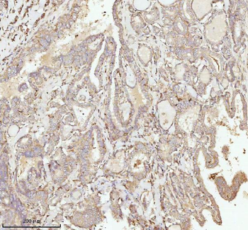 NDUFA9 Rabbit Polyclonal Antibody