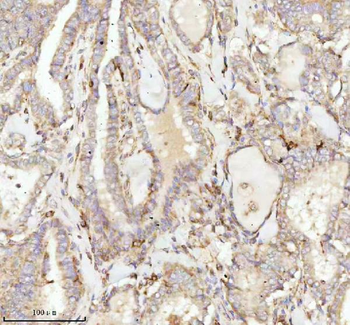 NDUFA9 Rabbit Polyclonal Antibody