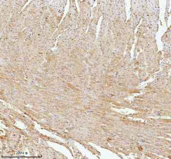 NDUFA9 Rabbit Polyclonal Antibody