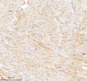 NDUFA9 Rabbit Polyclonal Antibody