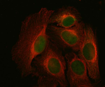 NDUFA9 Rabbit Polyclonal Antibody