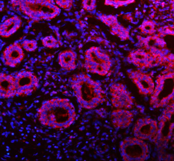 NDUFA9 Rabbit Polyclonal Antibody