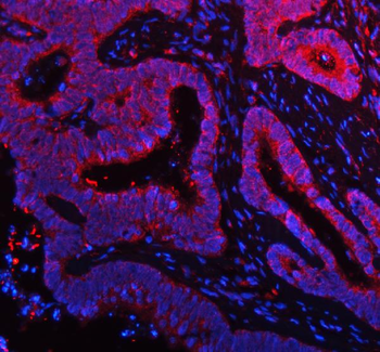 NDUFA9 Rabbit Polyclonal Antibody