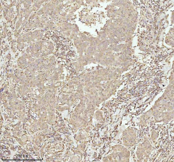 NDUFA9 Rabbit Polyclonal Antibody