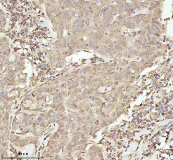 NDUFA9 Rabbit Polyclonal Antibody