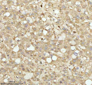 NDUFA9 Rabbit Polyclonal Antibody