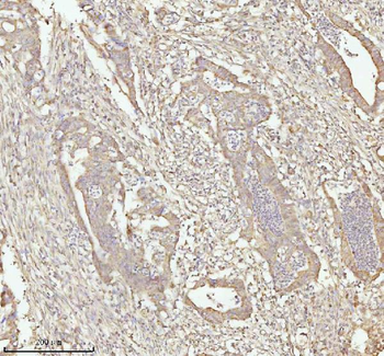 NDUFA9 Rabbit Polyclonal Antibody