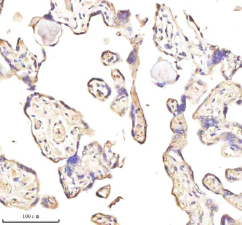 MEST Rabbit Polyclonal Antibody