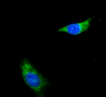 NDUFB8 Rabbit Polyclonal Antibody