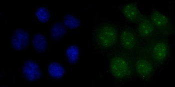 FEN1 Mouse Monoclonal Antibody