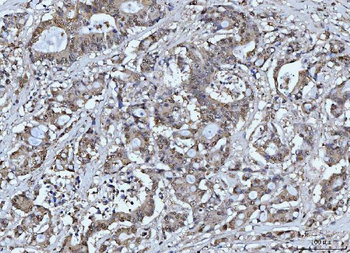 FEN1 Mouse Monoclonal Antibody