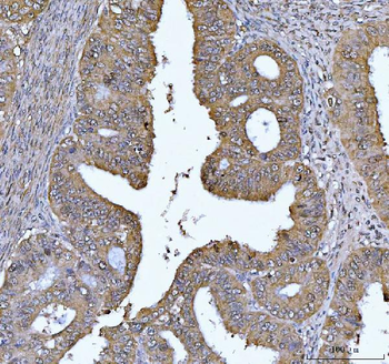FEN1 Mouse Monoclonal Antibody