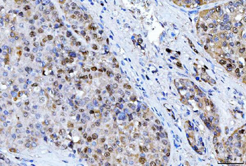 FEN1 Mouse Monoclonal Antibody