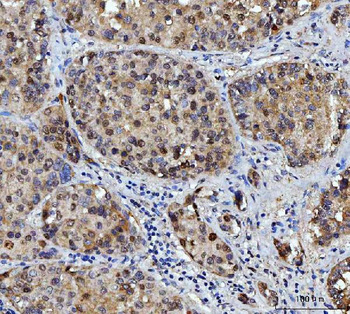 FEN1 Mouse Monoclonal Antibody