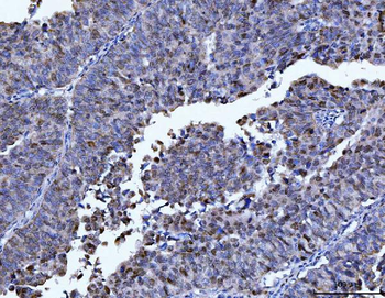 FEN1 Mouse Monoclonal Antibody
