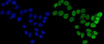 FEN1 Mouse Monoclonal Antibody