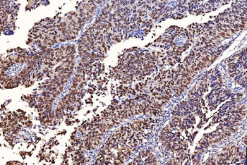 FEN1 Mouse Monoclonal Antibody