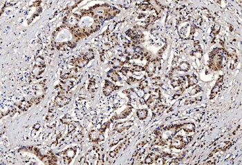 FEN1 Mouse Monoclonal Antibody