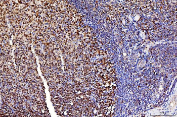 FEN1 Mouse Monoclonal Antibody