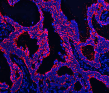 TMPRSS13 Rabbit Polyclonal Antibody