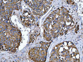 TMPRSS13 Rabbit Polyclonal Antibody