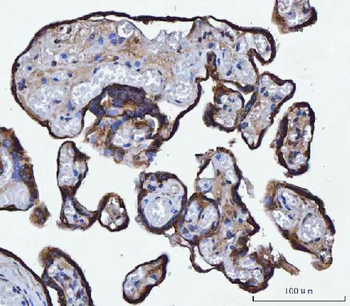TMPRSS13 Rabbit Polyclonal Antibody
