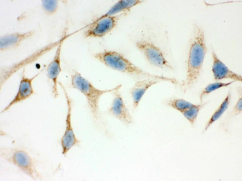 ERAB/HSD17B10 Rabbit Polyclonal Antibody