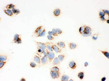 ERAB/HSD17B10 Rabbit Polyclonal Antibody