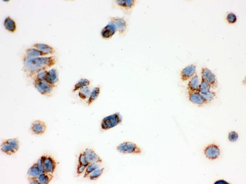 ERAB/HSD17B10 Rabbit Polyclonal Antibody