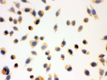 ERAB/HSD17B10 Rabbit Polyclonal Antibody