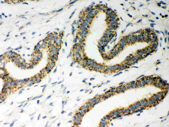 ERAB/HSD17B10 Rabbit Polyclonal Antibody