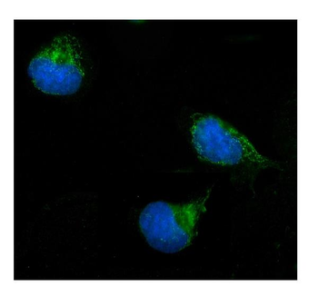 ERAB/HSD17B10 Rabbit Polyclonal Antibody