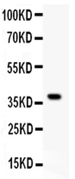 Glutamate Receptor 1/GRIA1 Rabbit Polyclonal Antibody