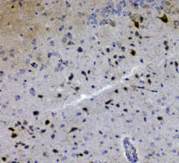GRIK1 Rabbit Polyclonal Antibody