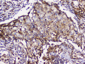 GRIK1 Rabbit Polyclonal Antibody