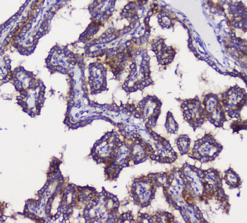 GRIK1 Rabbit Polyclonal Antibody