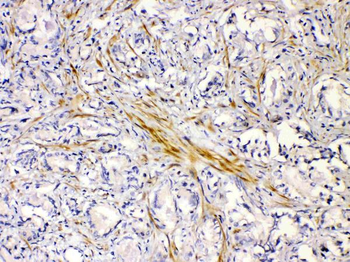 Nicotinic Acetylcholine Receptor alpha 5/CHRNA5 Rabbit Polyclonal Antibody